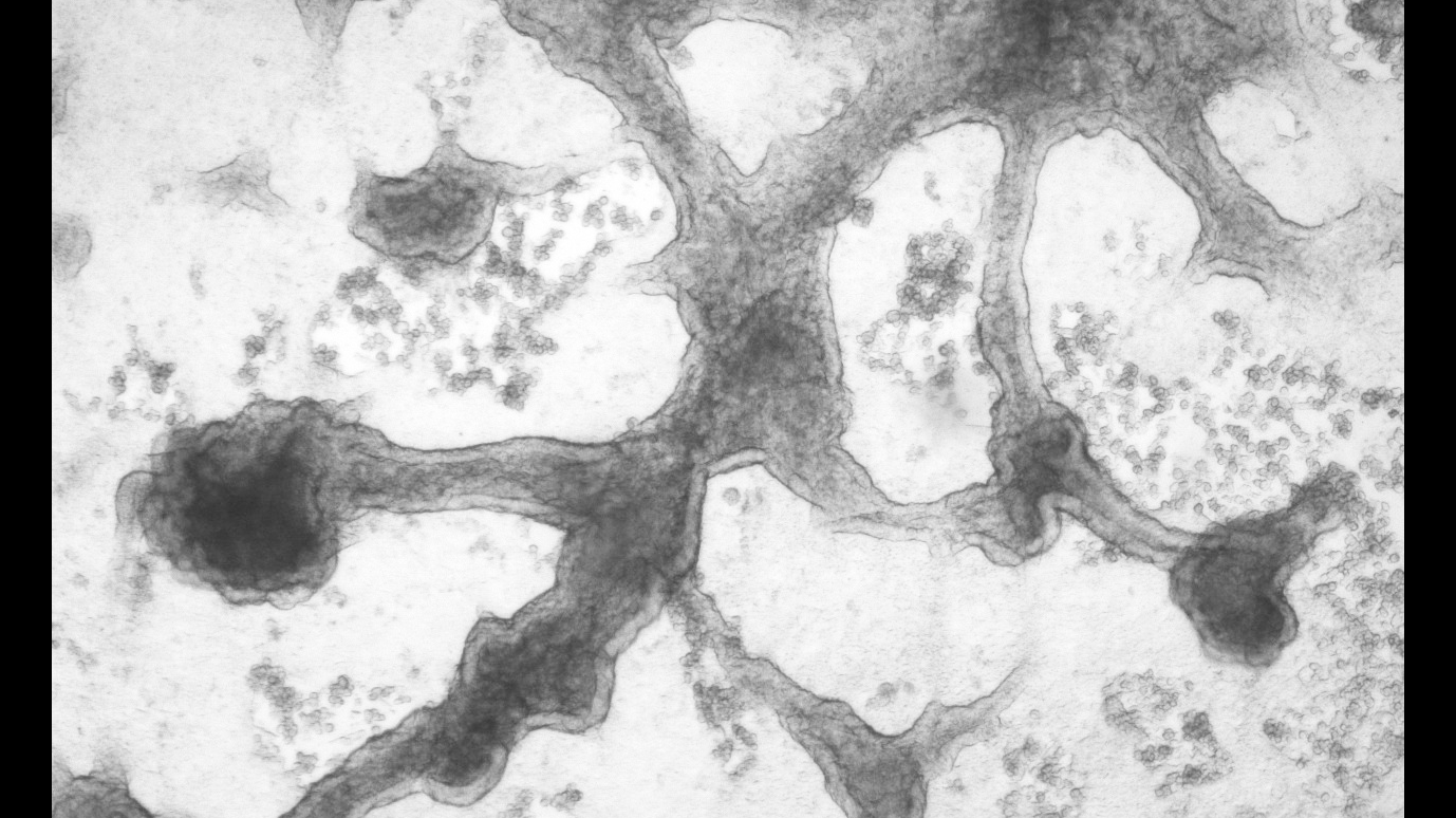 Lung cells