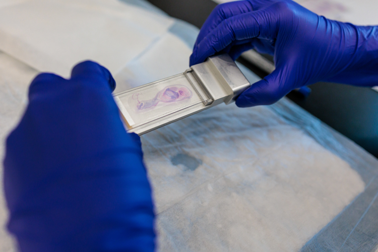 Hands wearing blue rubber gloves holding a sample on a microscope slide