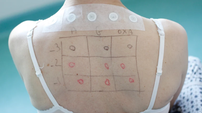 Image of dots on a back