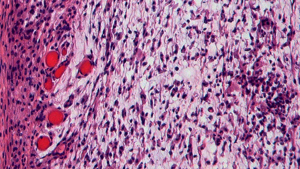 Pink abstract image representing a tissue sample