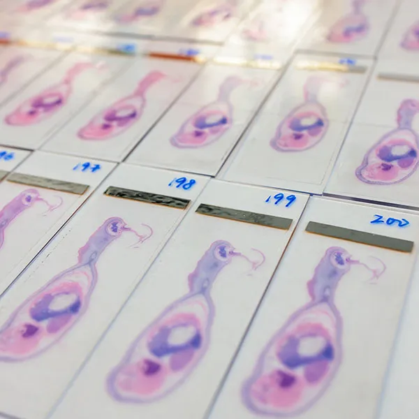Slides of cells