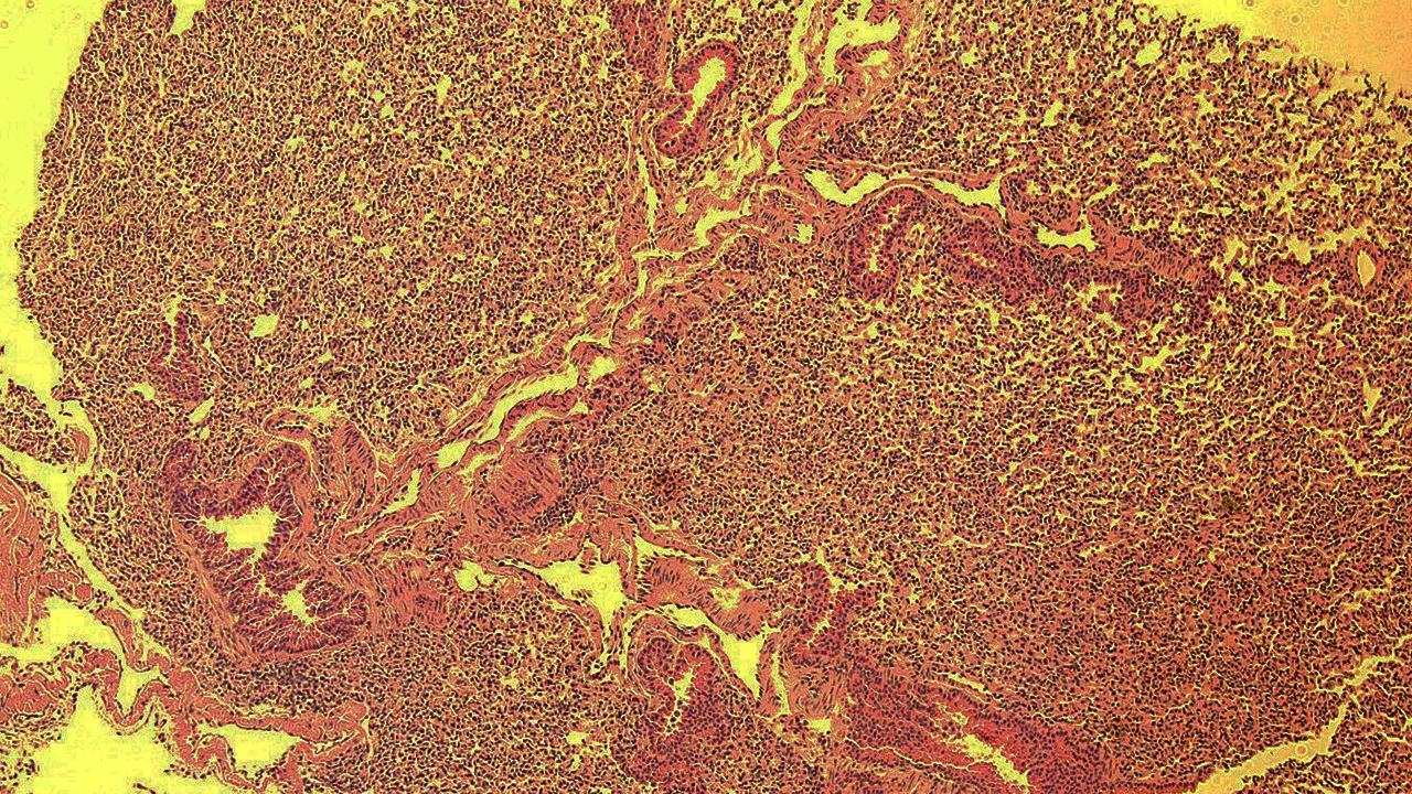A cross section of a microbe