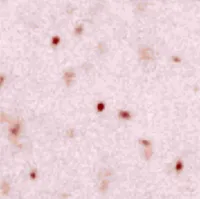 Confocal microscopy image showing individual nitrogen-vacancy centers in diamond as bright fluorescent spots. The isolated emitters are used for nanoscale quantum sensing and magnetic field measurements.